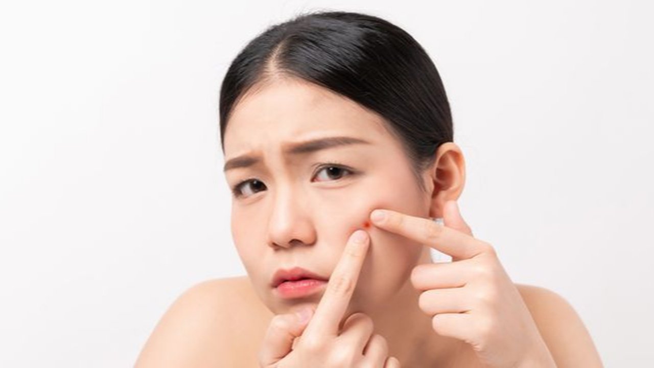 Punya Kulit Berjerawat? Simak Urutan Skincare Malam yang Paling Efektif untuk Hasil Maksimal
