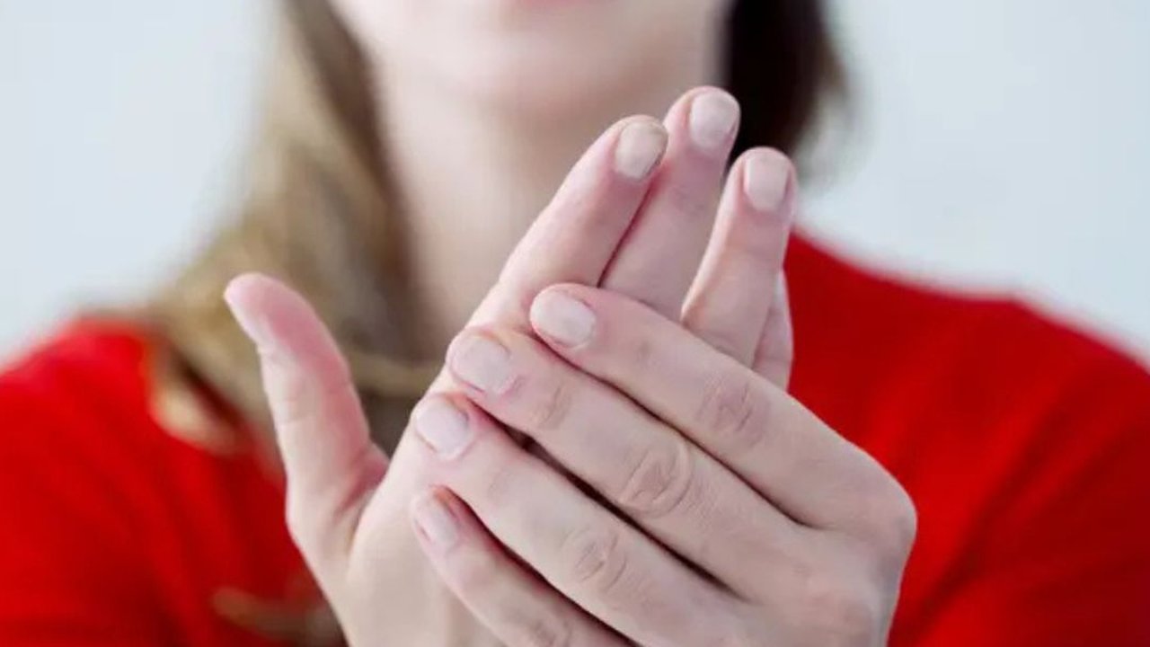 Kenali Tanda-Tanda Kolesterol Tinggi Melalui Gejala Unik di Tangan Anda, Jangan Anggap Remeh