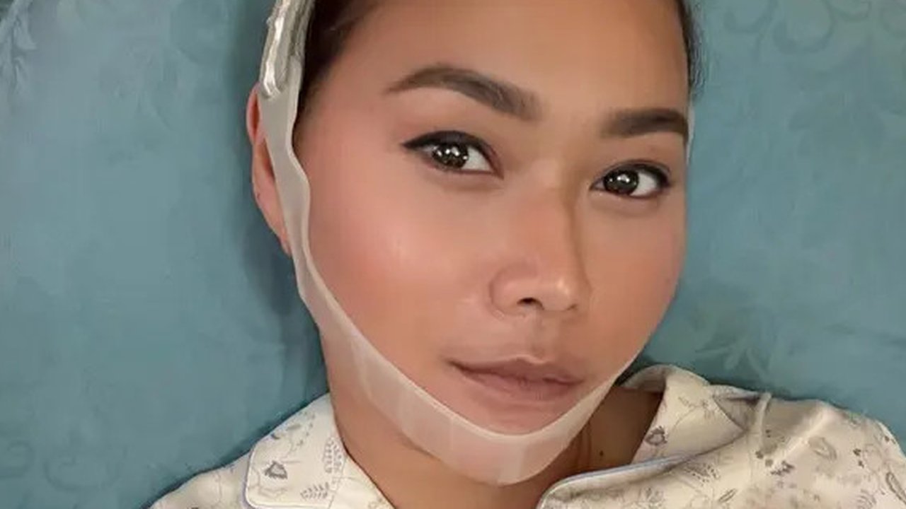 Potret Inul Daratista perawatan wajah tirus tanpa oplas. (sumber: Instagram/inul.d)