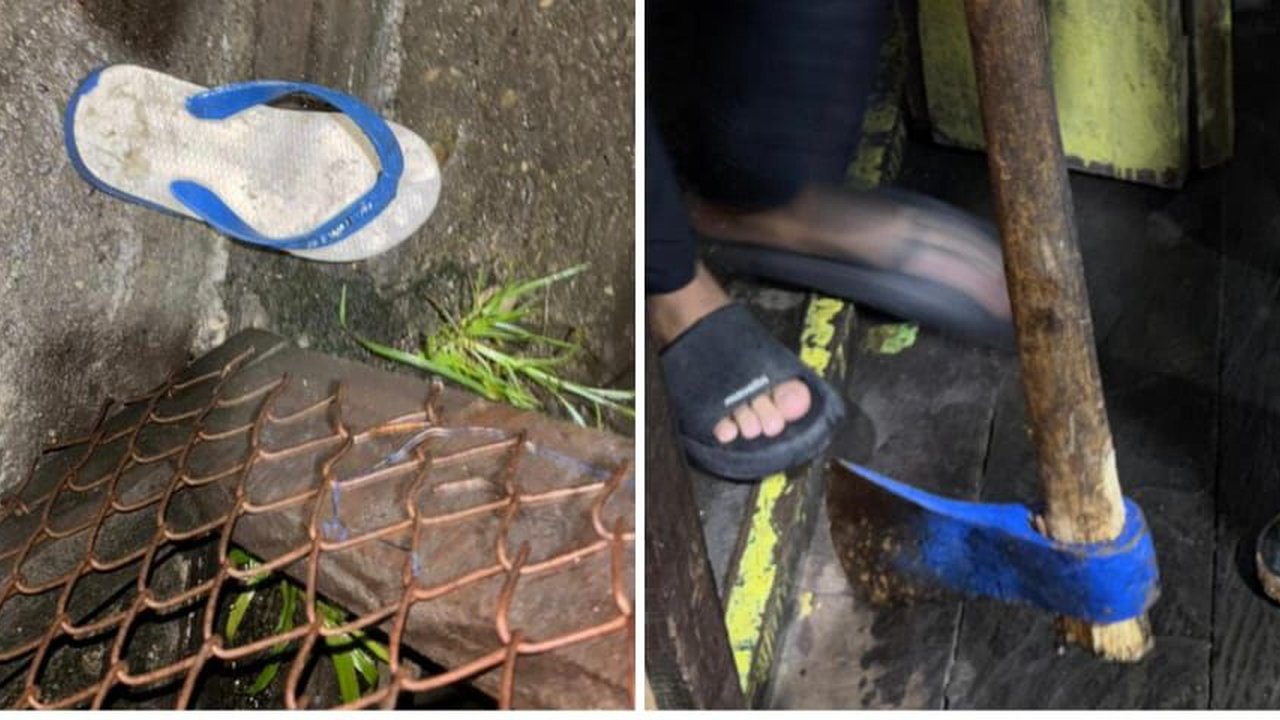 KKB Kembali Tebar Teror di Papua, Kali Ini Warga Dianiaya hingga Leher Luka Robek