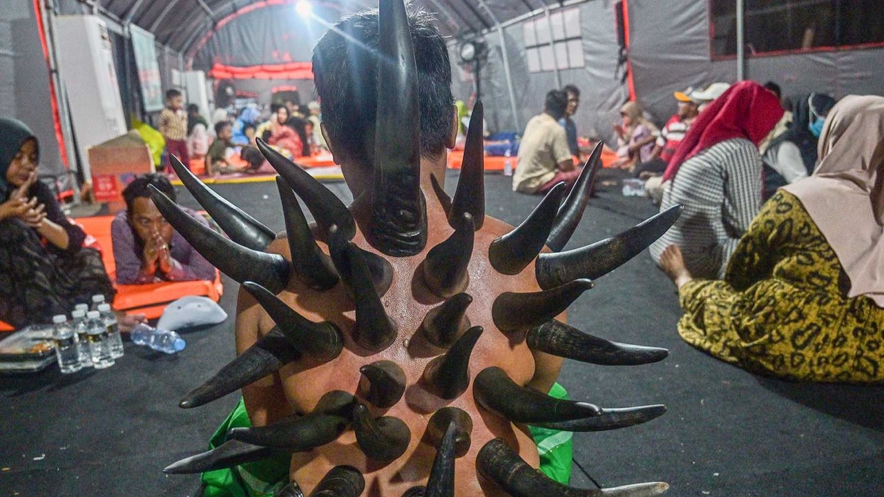 Seorang pria menjalani terapi bekam menggunakan tanduk sapi, yang disediakan oleh para relawan di tenda sementara yang didirikan untuk menampung keluarga santri yang hilang di Rumah Sakit Bhayangkara, Surabaya, Minggu (05/10/2025) malam.