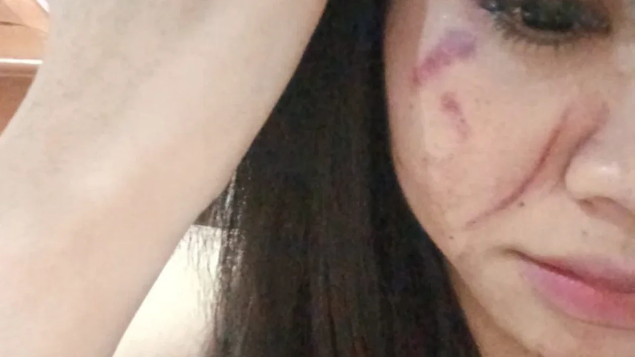 Tolak Hadiri Acara Ultah, Waria di Makassar Diserang Teman Sendiri hingga Wajahnya Dicakar