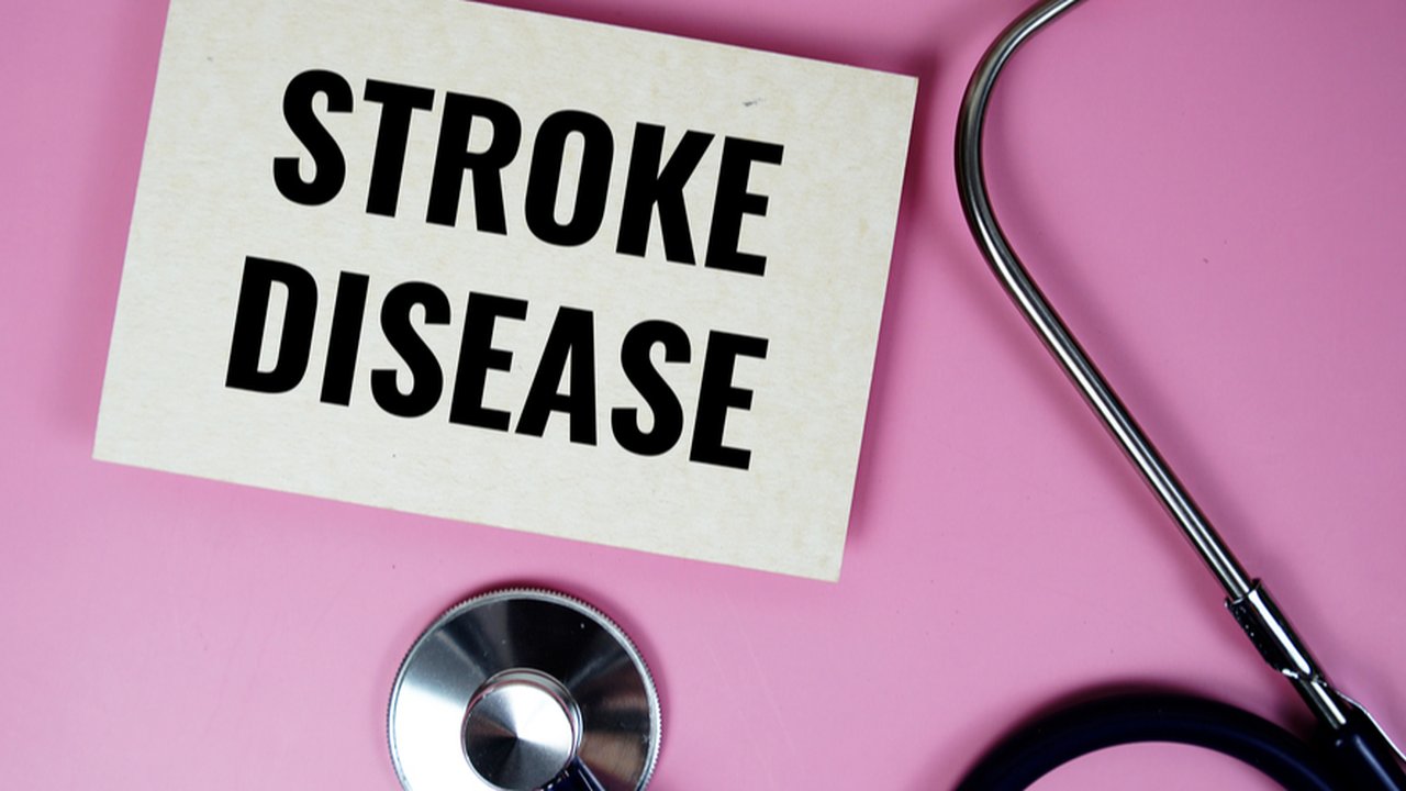 Ilustrasi penyakit stroke.