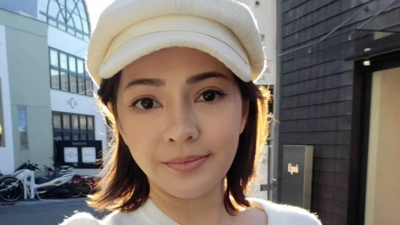 Maya Septha lakukan operasi kantong mata. (credit:instagram.com/mayaseptha7)