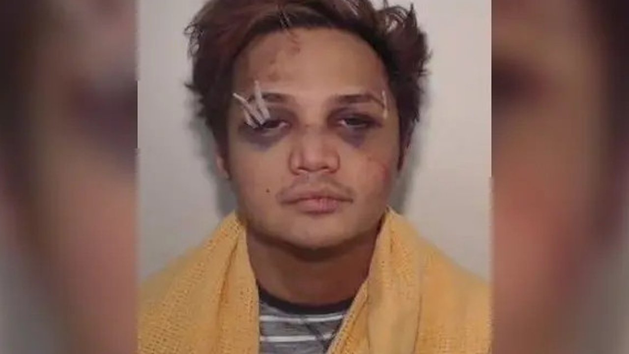 Dalam foto terbaru, predator seksual Reynhard Sinaga yang tinggal di Manchester, Inggris itu tampak babak belur pada bagian wajah (Greater Manchester Police)