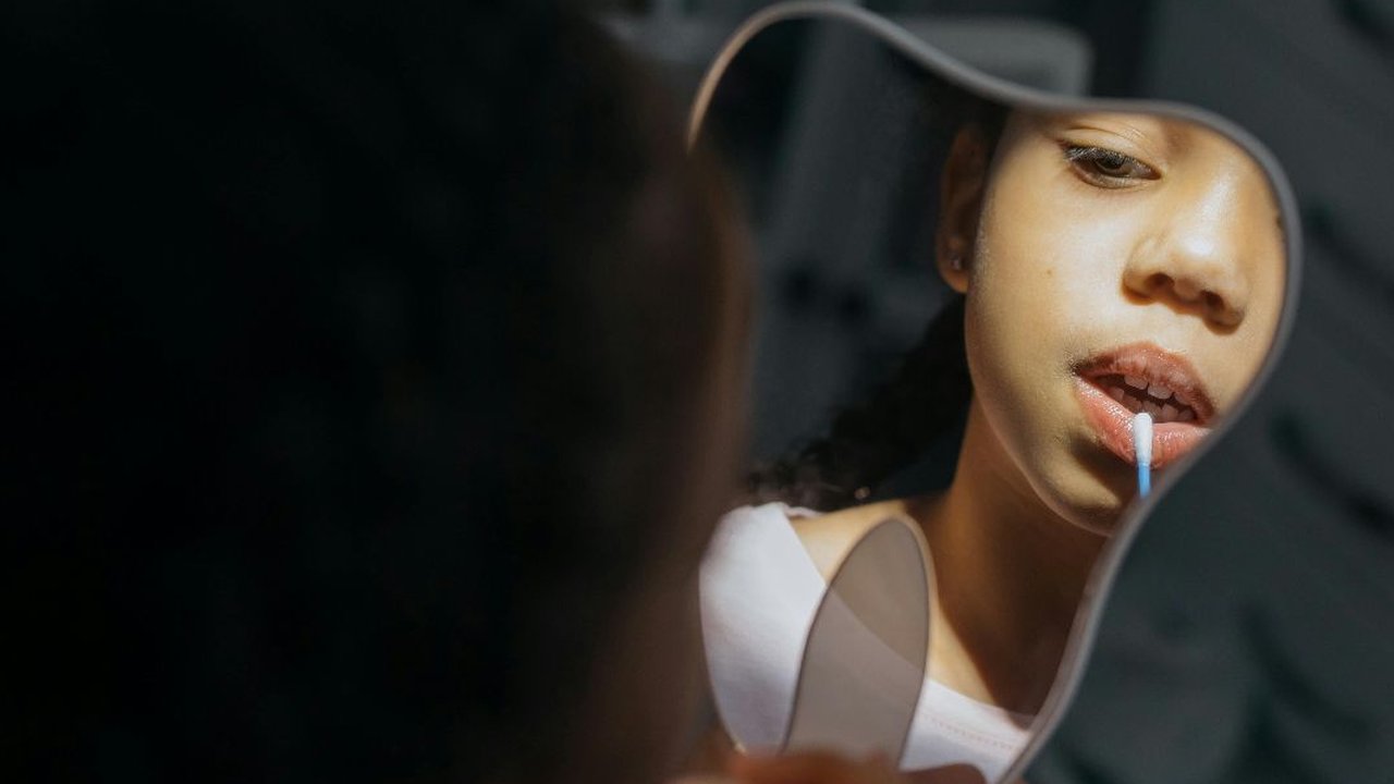 gigi kuning pada anak