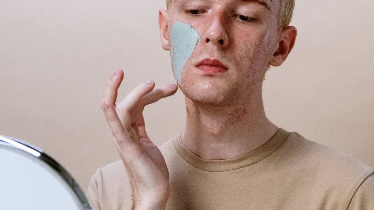 Jerawat hormonal disebabkan oleh peningkatan hormon androgen