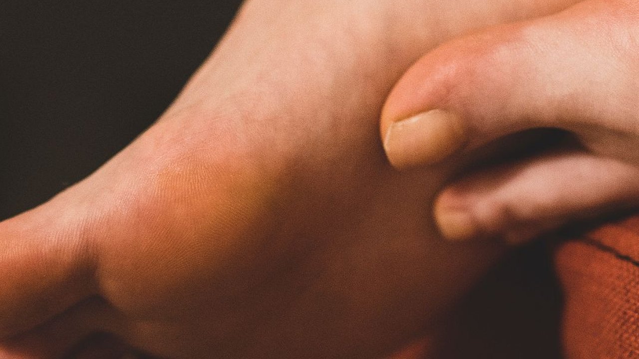 Kapalan tidak hanya bersifat estetis, tetapi juga dapat menjadi sumber ketidaknyamanan dan bahkan rasa sakit.