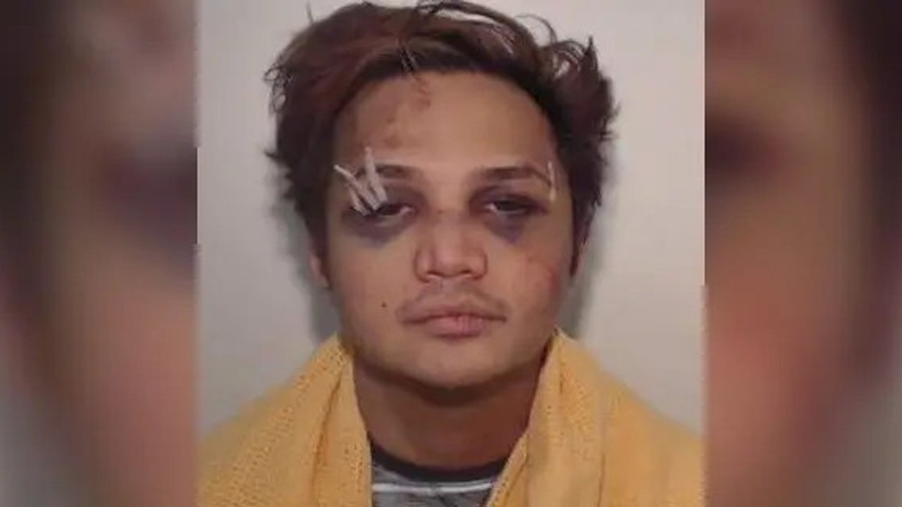 Dalam foto terbaru, predator seksual Reynhard Sinaga yang tinggal di Manchester, Inggris itu tampak babak belur pada bagian wajah (Greater Manchester Police)