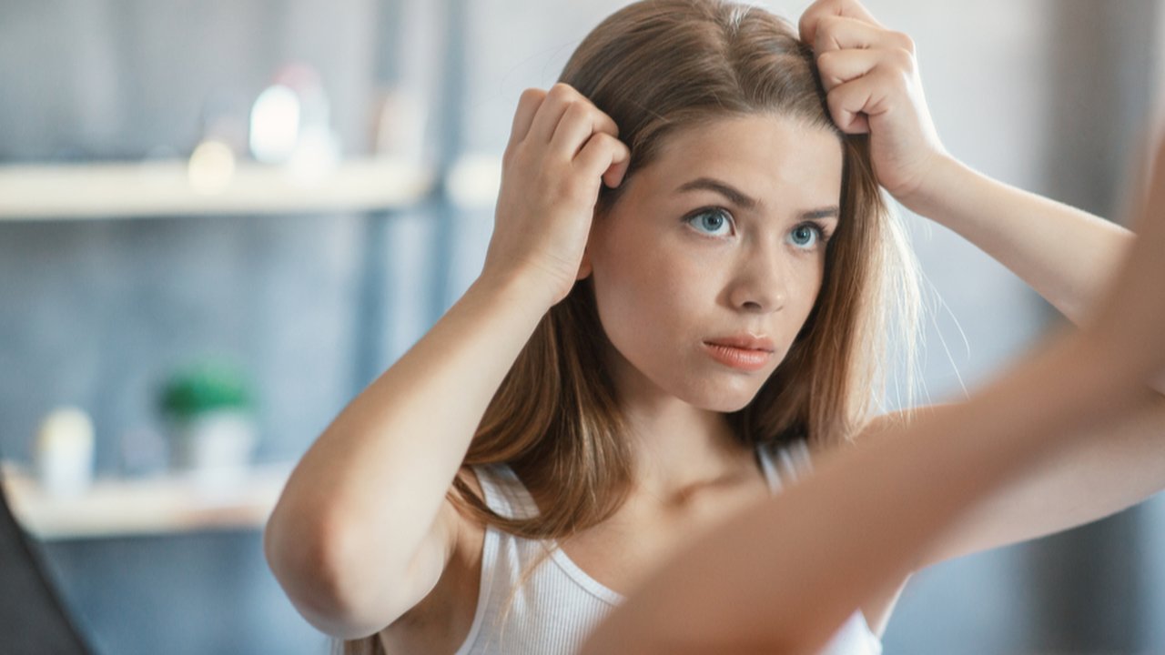 Ilustrasi kulit kepala tidak sehat.