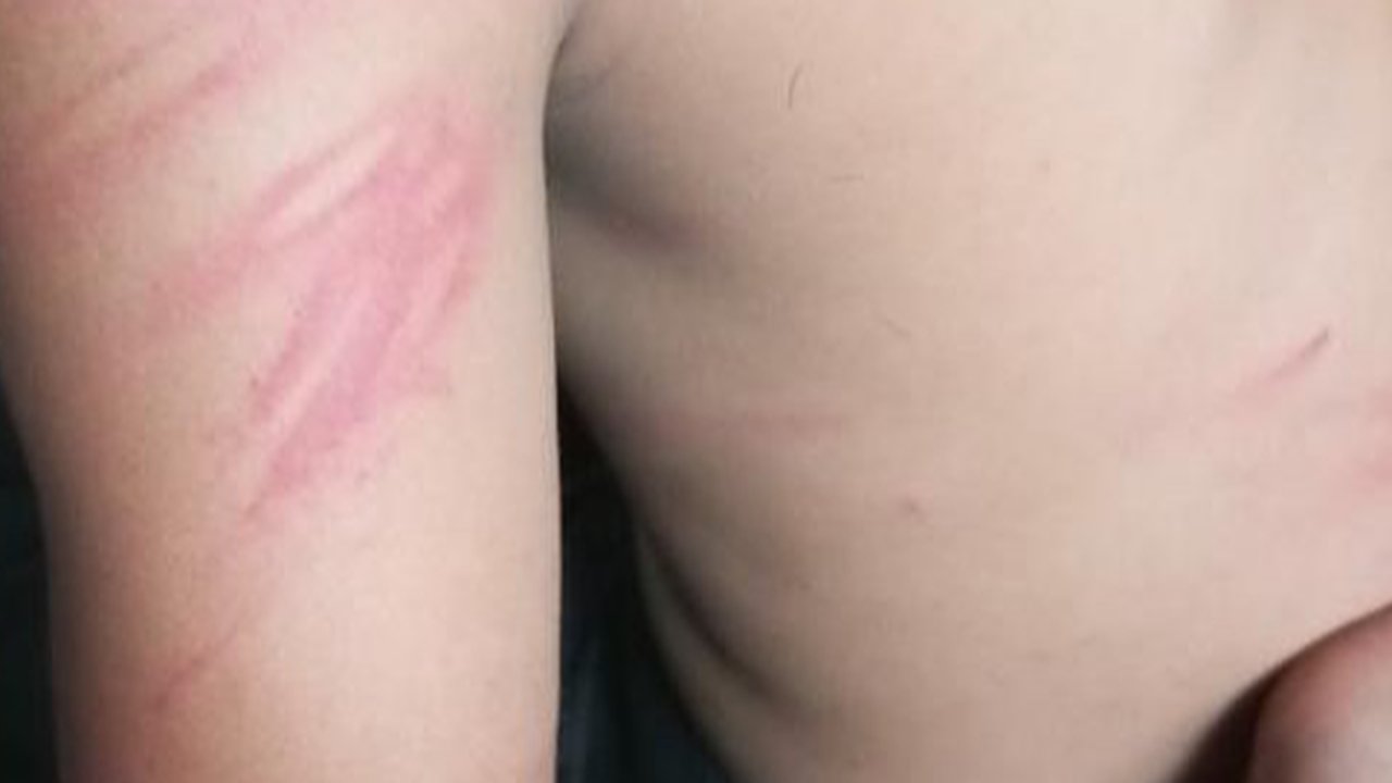 Tragis, Bocah SD di Palembang Diduga Disiksa 4 Satpam Gara-Gara Dituduh Curi Sayuran