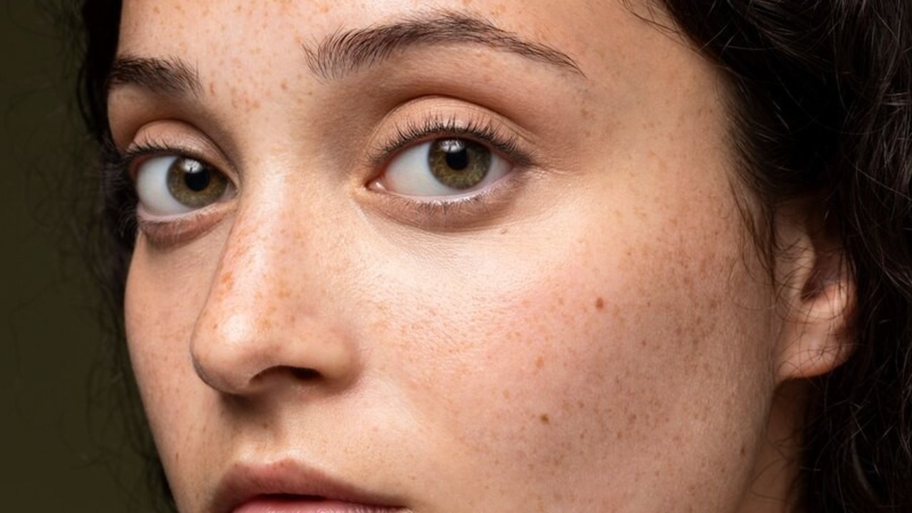 Vitamin C membantu menghalangi radikal bebas dan menghambat proses enzimatif yang menghasilkan melanin pada kulit sehingga dapat membantu mengurangi warna gelap pada kulit. Vitamin C juga men