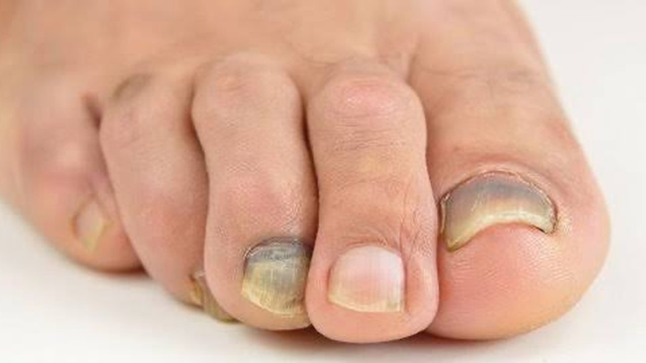 Menggunakan nail art dan press-on nails bisa merusak kuku, intip cara merawatnya berikut ini! [pexels/designcologist].