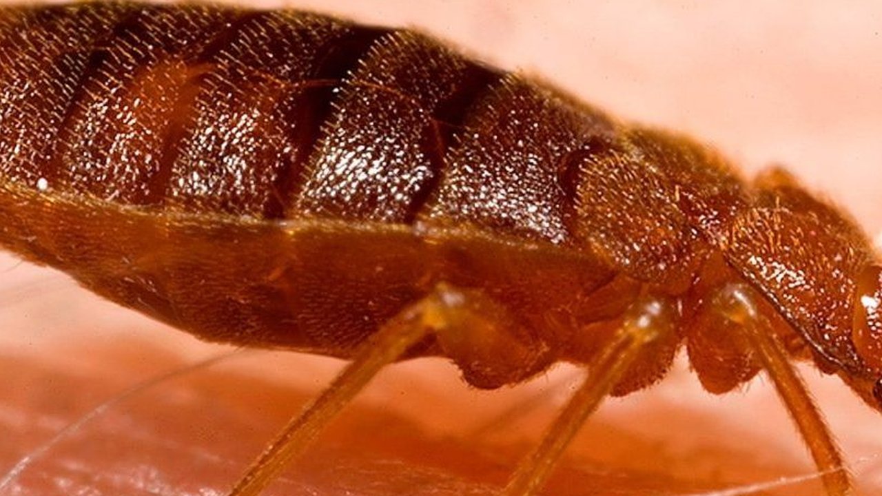 Orang Romawi terkenal pembersih, sehingga bukti penyebaran tungau ini cukup mengejutkan arkeolog.