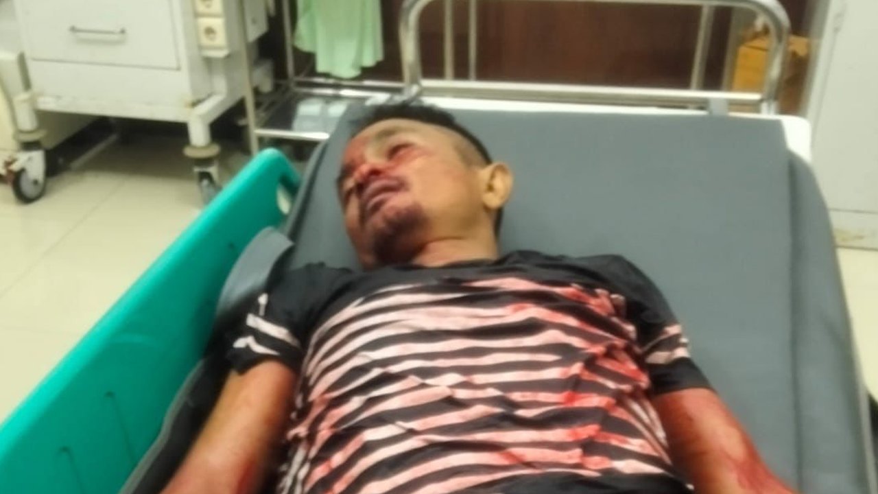 Ricuh di Tempat Karaoke saat Ramadan, Polisi Tewas Ditikam Preman