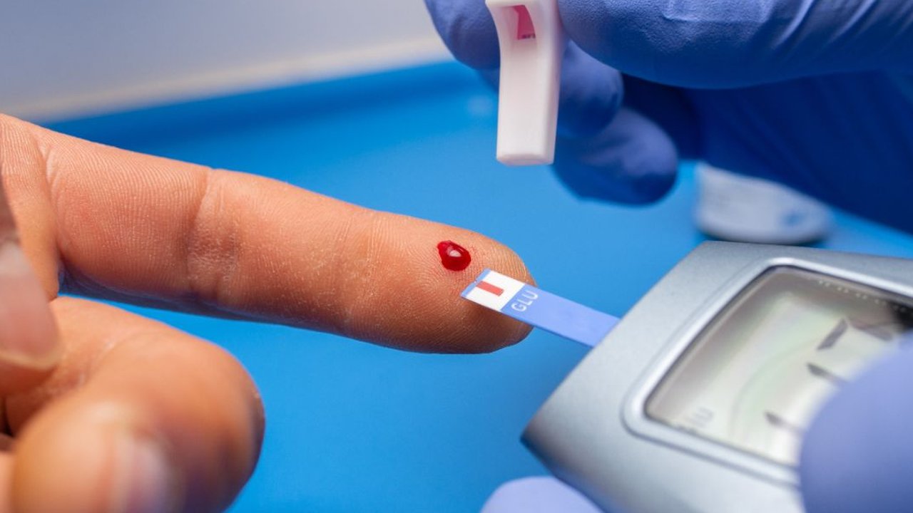 Kamu harus tahu berapa jumlah ukuran kolesterol yang normal, kolesterol yang sudah diambang batas, dan kolesterol yang tinggi pada tubuhmu. (Foto: Unsplash.com/Olga Kononenko)