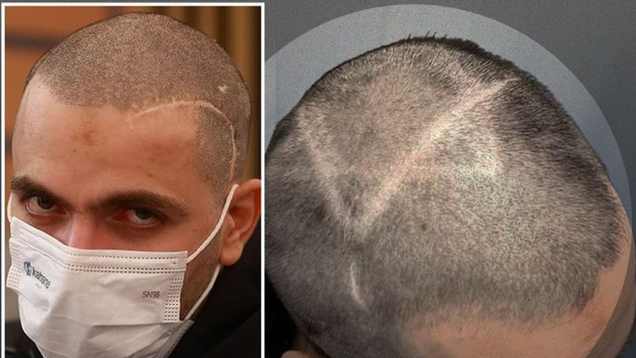 Sebelum Dibebaskan, Pasukan Israel Menggunduli Kepala Pria Palestina Ini dan Membuat Tanda Bintang Daud