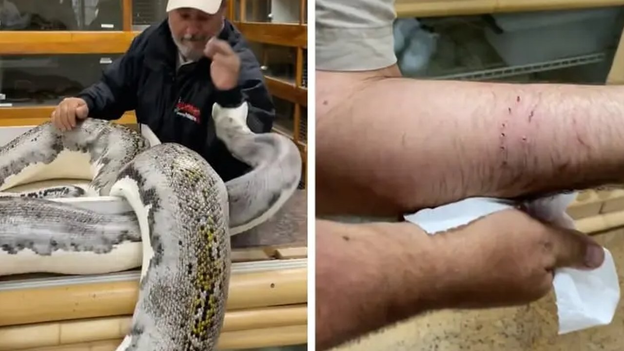 Ilustrasi Digigit Ular