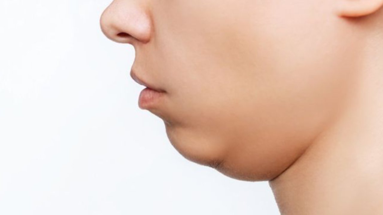 Ilustrasi Double Chin