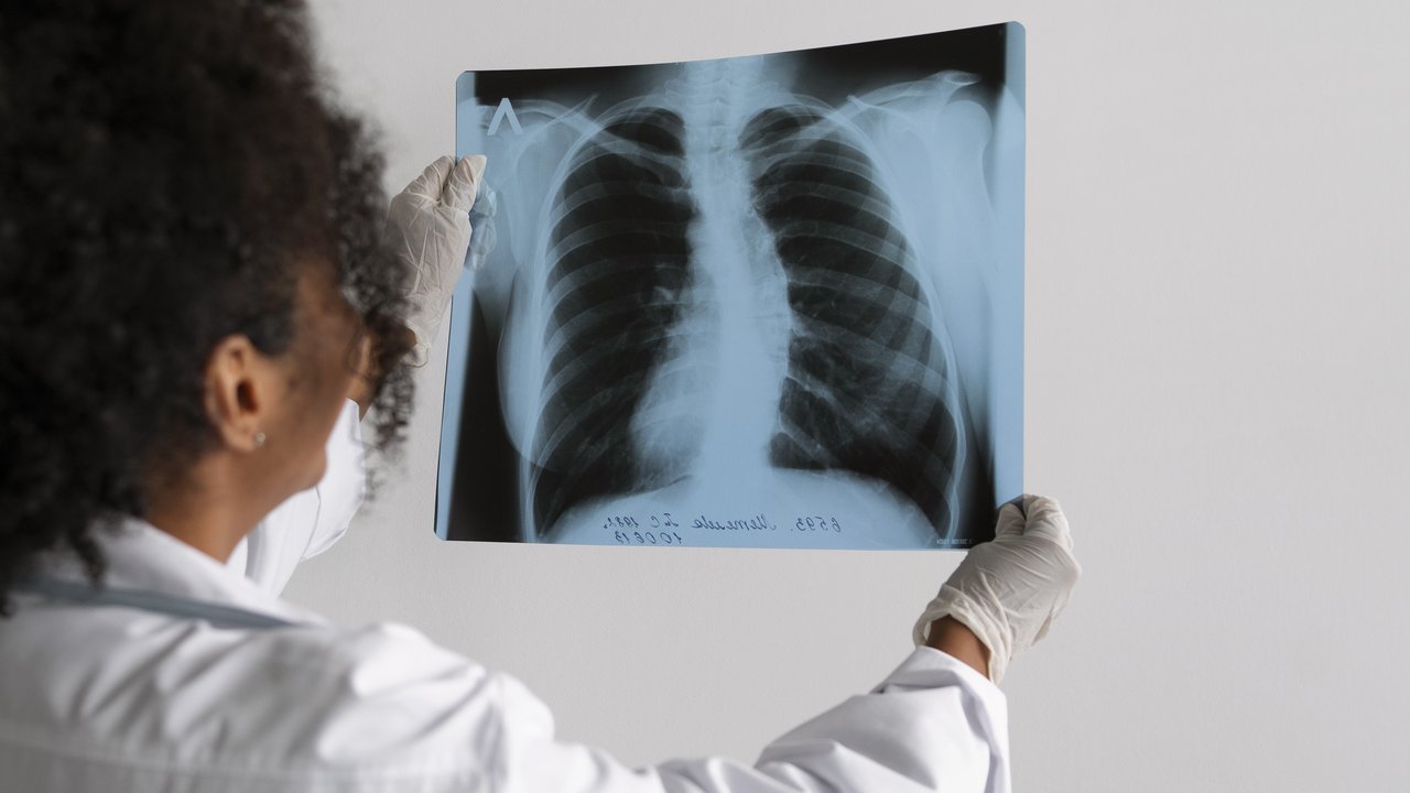 Seorang dokter sedang melihat hasil rontgen paru-paru (Foto Dok: Freepik/freepik).