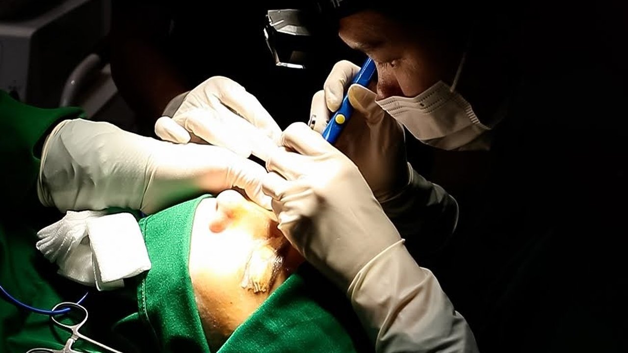 Proses Tanam Rambut Prosedur Seputar Area Mata