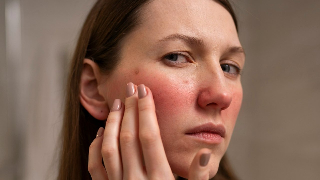Kulit Kering dan Dehidrasi Itu Beda—Ini Penjelasan Ahli Dermatologi