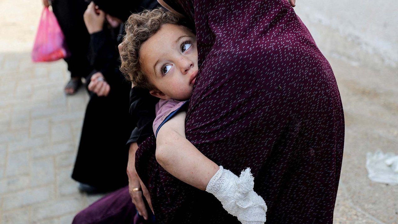 Seorang ibu menggendong anak yang tangannya terluka di rumah sakit Al Shifa, Kota Gaza, 18 Mei 2025. Minggu (18/05/2025).