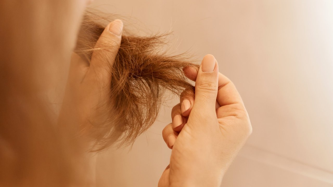 Ilustrasi Rambut Rusak (©Freepik)