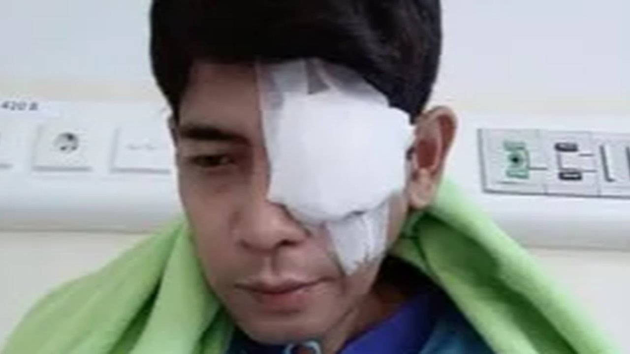 Lama Tak Terdengar Kabarnya, Begini Kondisi Veri AFI Usai Jalani Operasi Mata Kiri