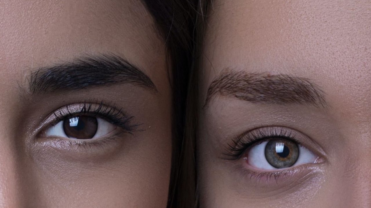 ilustrasi ketombe di alis