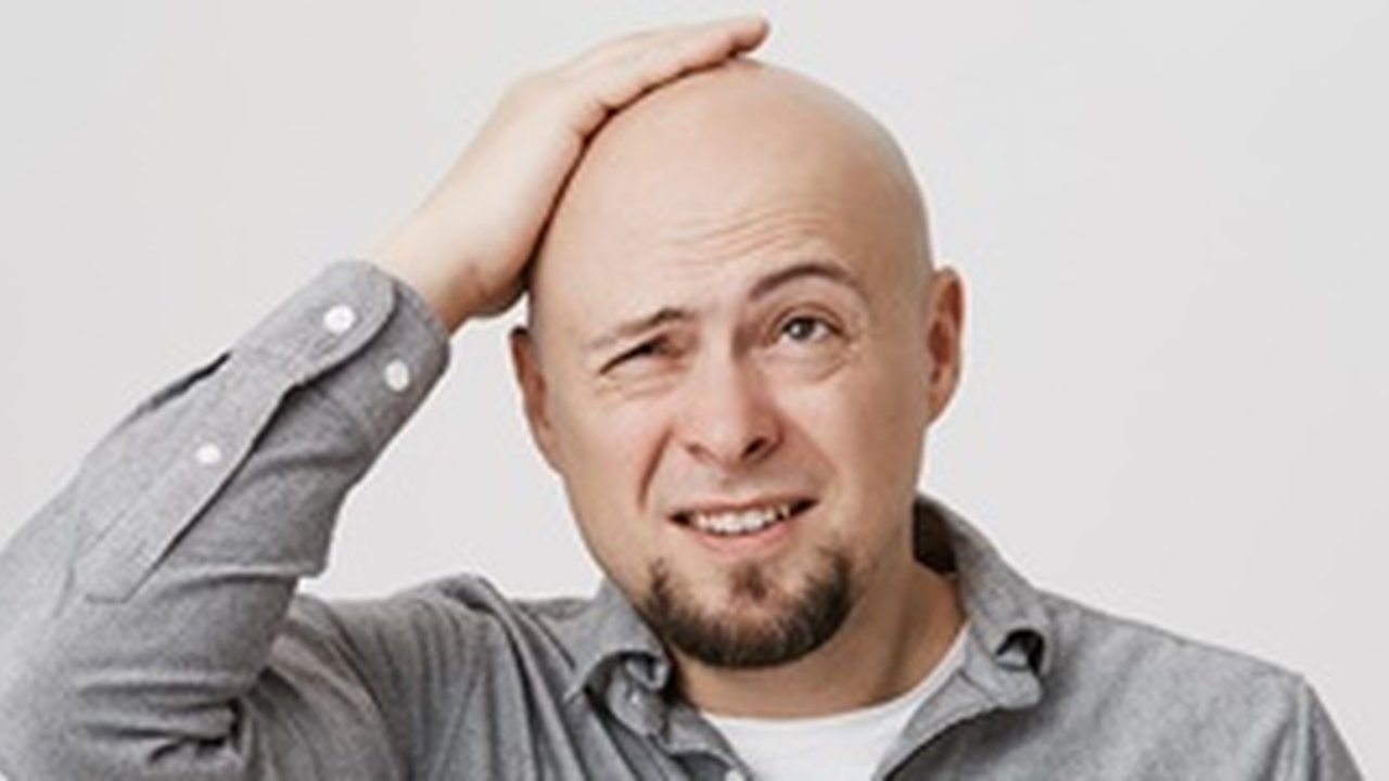10 Cara Menumbuhkan Rambut Botak Secara Alami, Salah Satunya dengan Bawang Merah