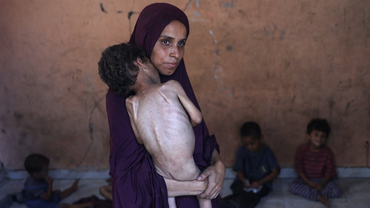 Naeema, seorang ibu Palestina (30 tahun) menggendong putranya yang berusia 2 tahun, Yazan, yang kekurangan gizi, saat mereka berdiri di rumah mereka yang hancur di kamp pengungsi Al-Shati, sebelah barat Kota Gaza, Rabu (23/07/2025).