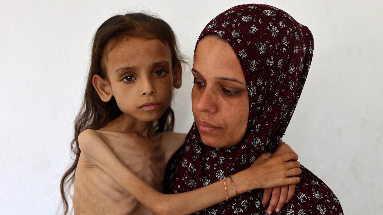 Mariam Dawwas, gadis Palestina berusia sembilan tahun yang kekurangan gizi, digendong oleh ibunya di lingkungan Rimal di Kota Gaza, Sabtu (02/08/2025).  Organisasi Kesehatan Dunia (WHO) memperingatkan pada 27 Juli bahwa malnutrisi telah mencapai