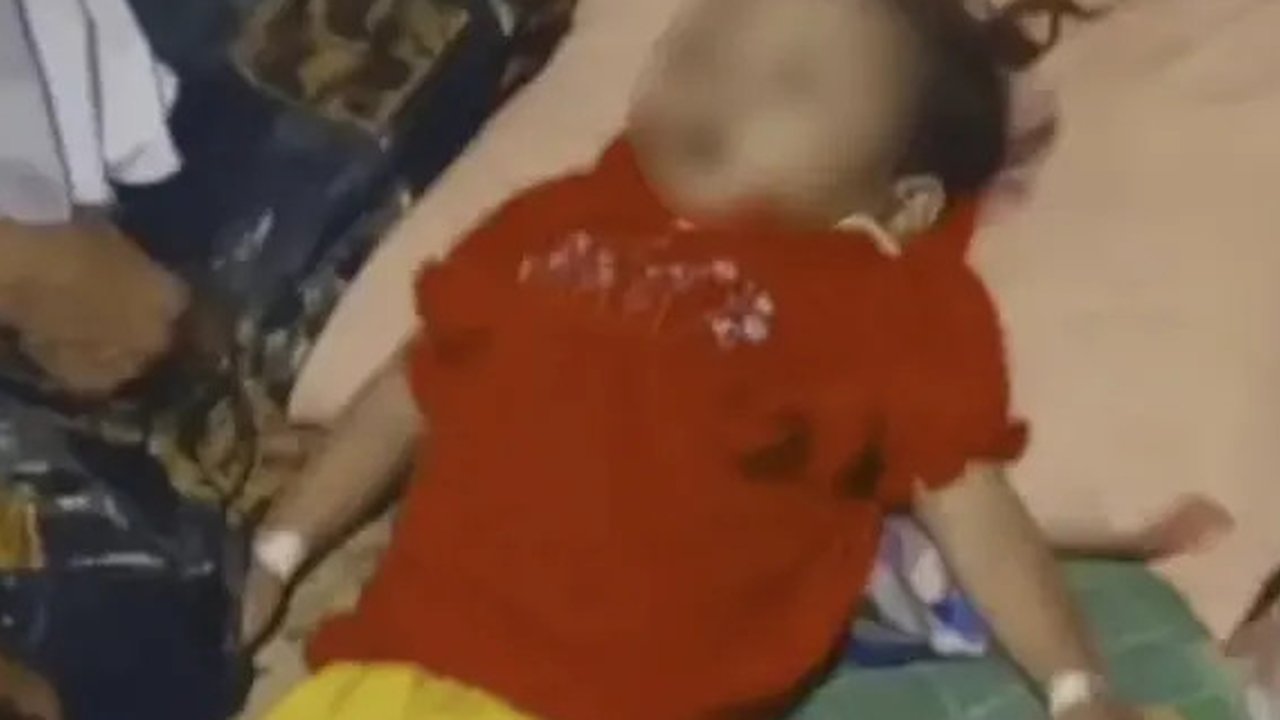 Menkes: Kematian Balita Raya di Sukabumi Bukan karena Cacingan