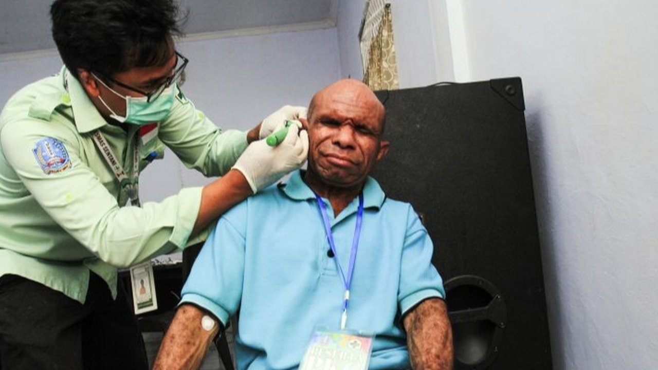 Dokter spesialis THT menjelaskan risiko serius membersihkan telinga dengan korek kuping, termasuk penyumbatan, kerusakan gendang telinga, dan infeksi, serta menganjurkan pemeriksaan dini jika terjadi gangguan pendengaran.