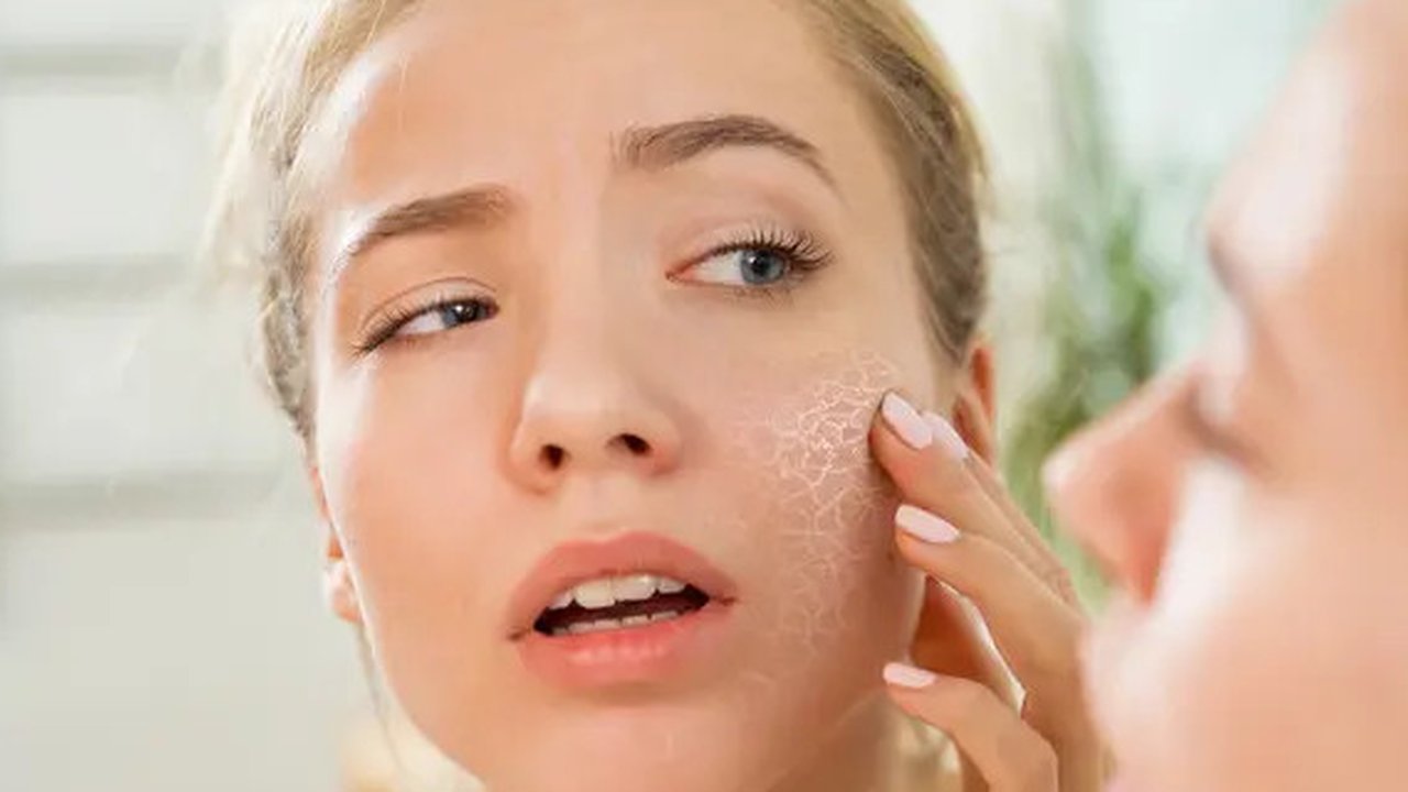 Kulit Kering Karena AC