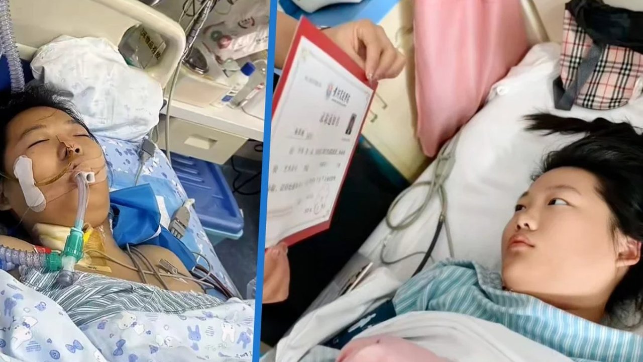 gadis china bangun dari koma