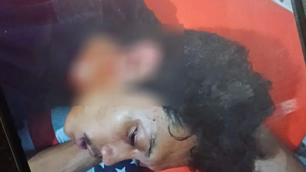 Kejadian Mencekam di UNM, 2 Mahasiswa Terluka Usai Dilempar Bom Molotov