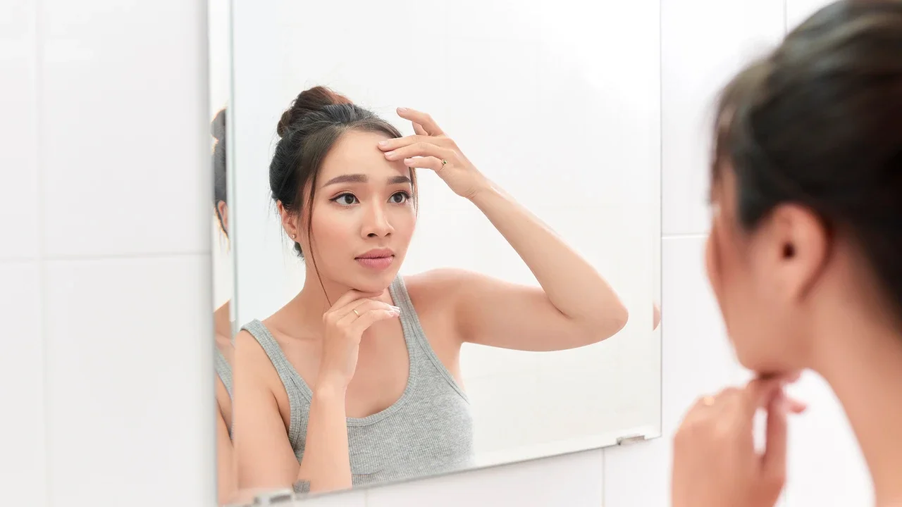 Potret perempuan cantik dengan masalah jerawat.