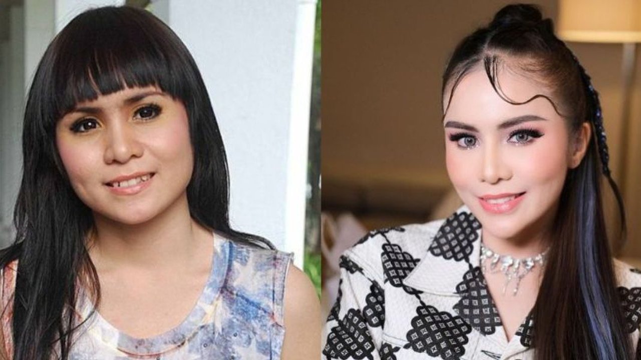 6 Potret Seleb Sebelum dan Sesudah Hilangkan Gigi Gingsul, Apakah Lebih Cocok?