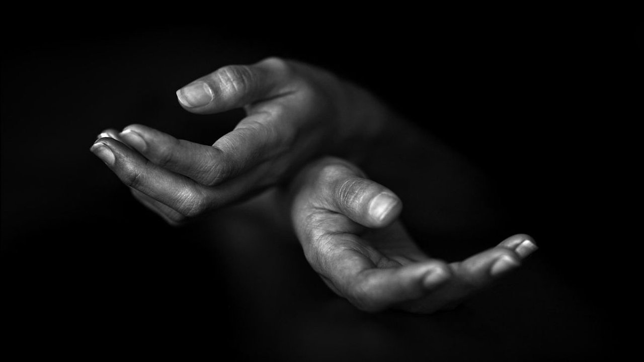 Cara Menyembuhkan Vitiligo dengan Cepat, Ketahui Penyebabnya