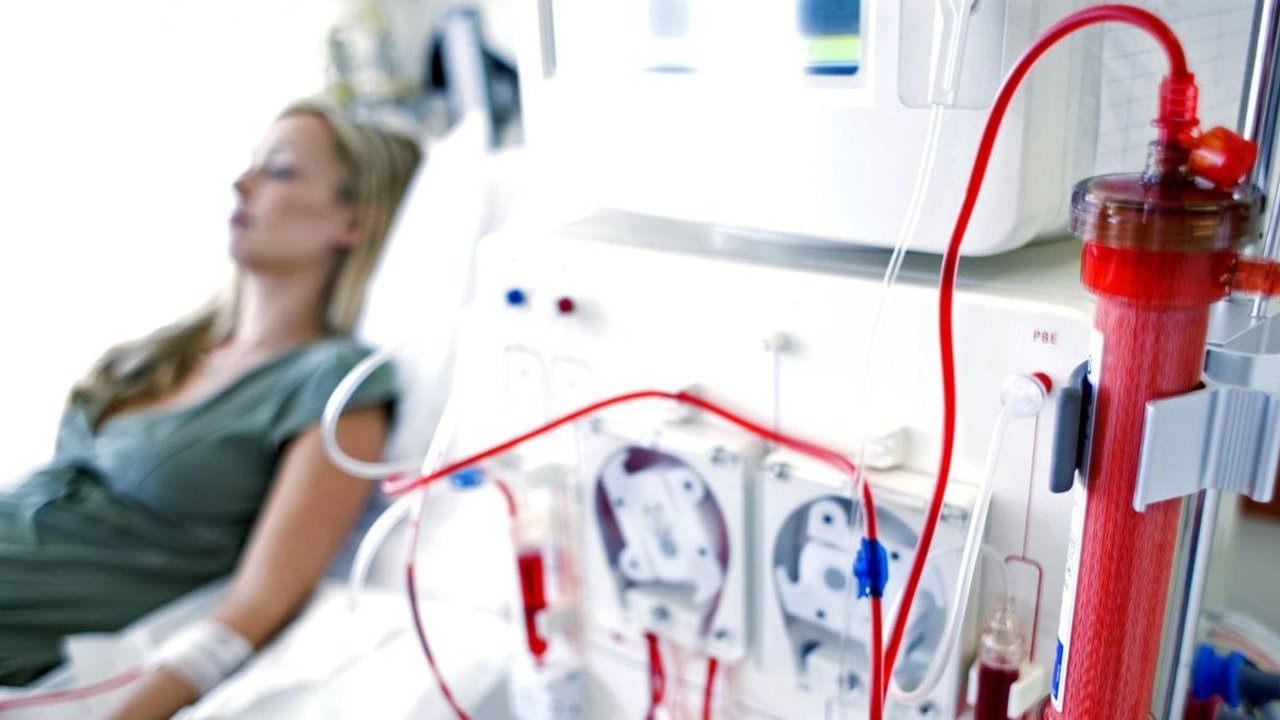 Mengenal Hemodialisa: Tujuan, Cara Kerja, dan Efek Sampingnya
