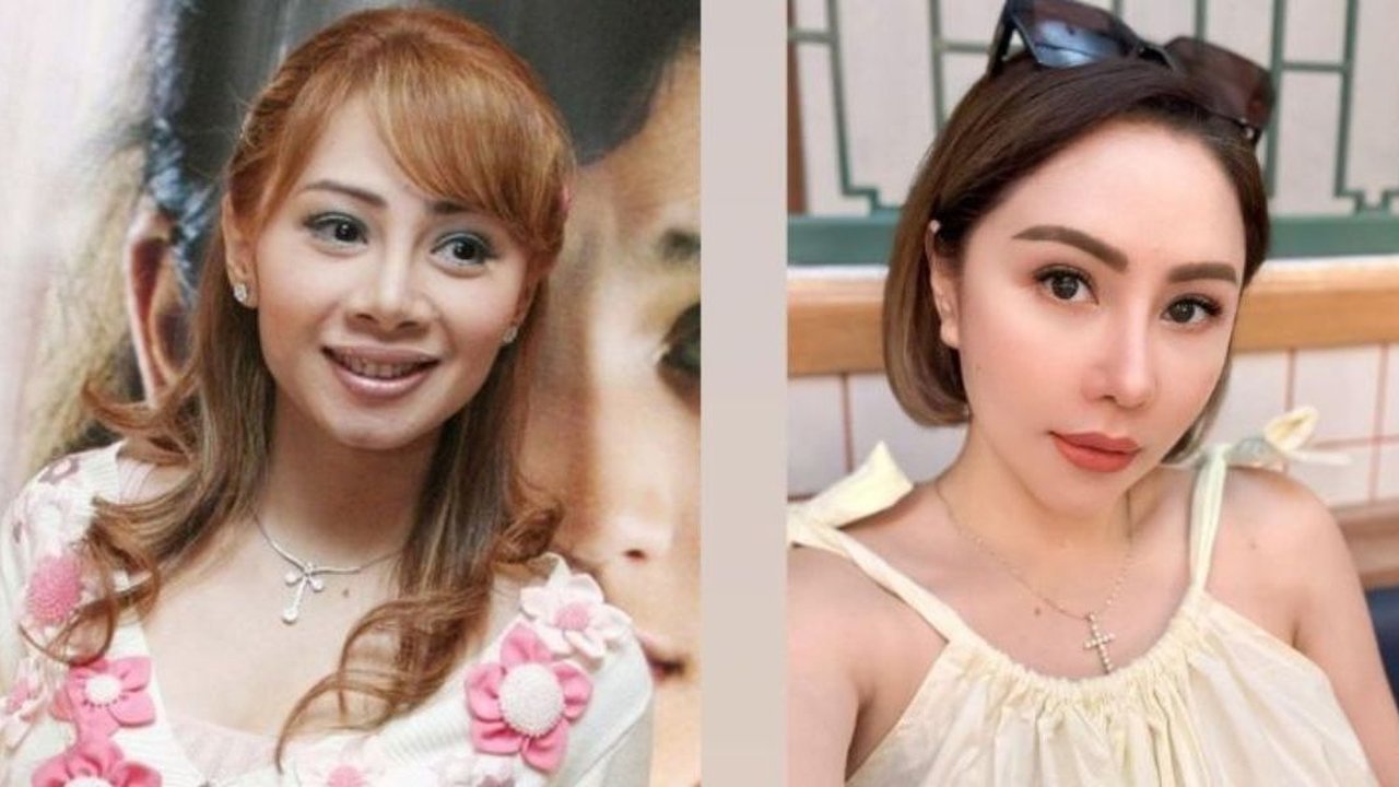 9 Transformasi Artis Sebelum dan Sesudah Filler Dagu, Wajah Makin Tirus Bikin Pangling