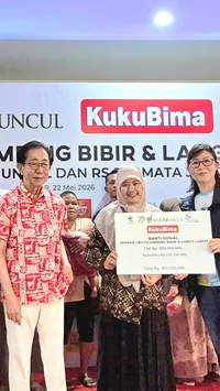 Dari Aksi Sosial ke Senyum Baru, KukuBima Sido Muncul dan Yayasan TOP Gelar Operasi Bibir Sumbing Gratis