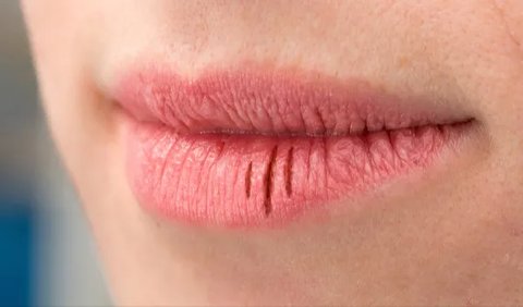Ketika bibir dalam kondisi kering dan pecah-pecah, mayoritas orang melumasinya dengan cara menjilat bibir.