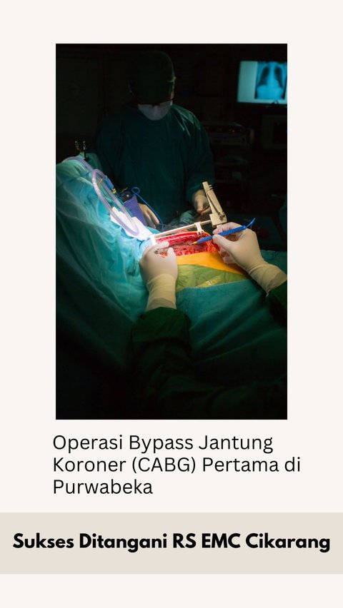 Operasi Bypass Jantung Koroner (CABG) Pertama di Purwabeka Sukses Ditangani RS EMC Cikarang