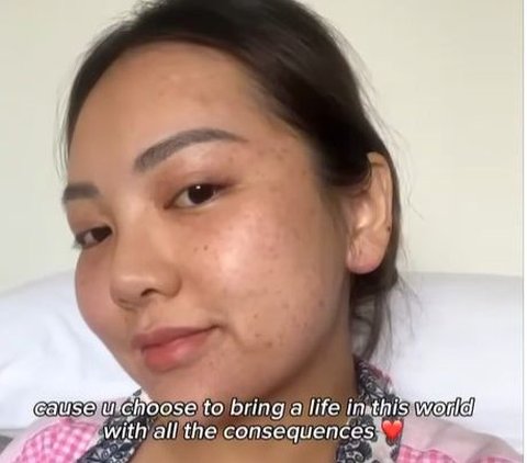Instagram Influencer Gives Birth Naturally Until Blood Vessels in the Eye Burst