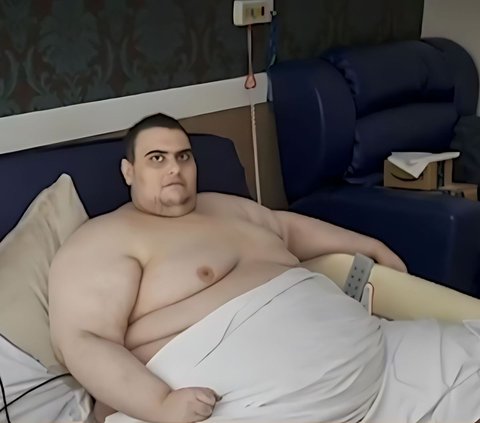 Hobby of Eating Makes This Young Man Obese with a Weight of Almost 300 Kg, Now Begging to be Injected with Magical Weight Loss Medicine