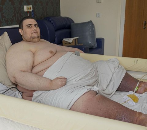 Hobby of Eating Makes This Young Man Obese with a Weight of Almost 300 Kg, Now Begging to be Injected with Magical Weight Loss Medicine