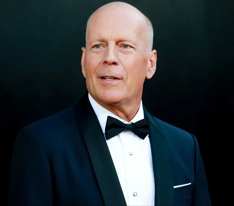 Bruce Willis Alami Demensia Frontotemporal Hingga Kesulitan Berkomunikasi, Mengungkap Fakta Tentang Penyakitnya